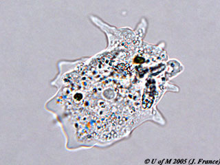 Amoeba under microscope 40x